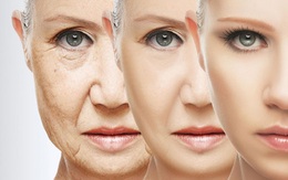 Muốn ngăn ngừa lão hóa da cần biết những điều này
