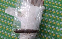 Trưởng công an xã ở Quảng Ngãi bị thanh gỗ đâm xuyên bàn chân khi giúp dân chống lũ