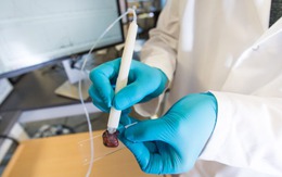 Thiết bị phát hiện được ung thư chỉ trong 10 giây