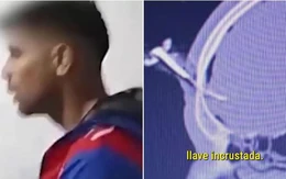 Cầu thủ Argentina nhập viện vì bị đâm chìa khóa xe xuyên qua hộp sọ