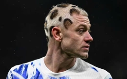 Ngôi sao người Na Uy gây sốc với kiểu tóc quái dị