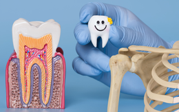 Vì sao răng không được xem là xương?