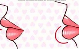 Quiz: Bờ môi tiết lộ gì về tính cách của bạn