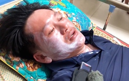 Ba người sống sót thần kỳ trên biển: Bắt cua, cá ăn sống, uống nước mưa cầm hơi