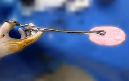 Bác sĩ cảnh báo xu hướng đáng lo gia tăng ở nhóm trẻ gái 10-16 tuổi