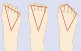 Nhìn dáng bàn chân, đoán ngay tính cách thật của bạn