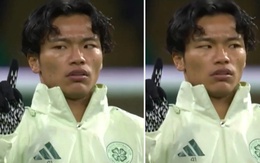 Reo Hatate gây sốt với màn ‘kiểm tra mắt’ kỳ lạ trước trận gặp AS Roma