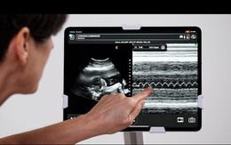 Mẹ bầu nên biết: Siêu âm tim thai giúp bác sĩ chuẩn bị gì cho bé sau sinh?