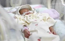 Bé gái Hàn Quốc sinh non chỉ nặng 328 gram, 6 tháng sau nặng 4kg