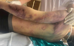 Học viên Trung tâm công tác xã hội Hải Hà bị đánh chết sau 2 ngày nhập học