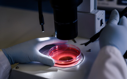 Công nghệ hình ảnh siêu nhạy giúp phát hiện ung thư sớm