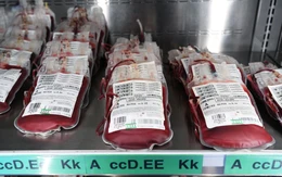 Nhóm máu liên quan đến nguy cơ mắc ung thư dạ dày