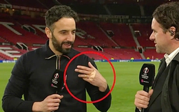 HLV Amorim của Man Utd bị thương bàn tay vì thói quen khó bỏ