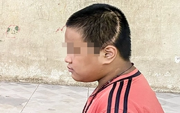Vụ học sinh lớp 3 bị tông chấn thương sọ não: Ai chịu trách nhiệm bồi thường?