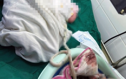 Sản phụ ở Đồng Nai sinh con 'thuận tự nhiên', không cắt dây rốn, ngâm bánh nhau trong thau muối hột