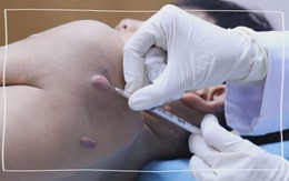 Góc nhìn trưa nay: Sai lầm khi tin vào xóa sẹo 100%