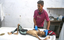 Gaza: viện trợ và cái chết