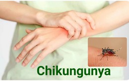 Bệnh Chikungunya đang diễn biến phức tạp, ai cần cẩn trọng?