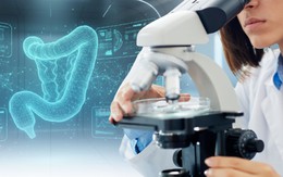 Không cần nội soi, phương pháp này giúp phát hiện đến 90% ca ung thư đại trực tràng