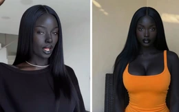 Phát hiện gây sốc về cô gái được mệnh danh 'đẹp nhất thế giới'