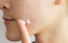 Một công ty bị thu hồi, đình chỉ lưu hành 77 loại mỹ phẩm