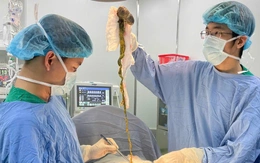 Phẫu thuật lấy búi tóc chiếm hết dạ dày bé trai 6 tuổi