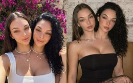 Cặp sinh đôi dính liền 'đánh lừa' hàng trăm ngàn người