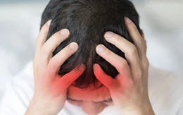 Có nên tự bổ sung vi chất để trị đau đầu, chóng mặt?