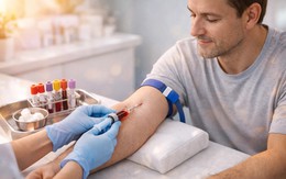 Nghiên cứu mới đặt vấn đề về yêu cầu nhịn đói trước xét nghiệm máu