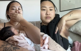 Người phụ nữ sau sinh 'mọc' thêm bầu ngực thứ ba ở nách