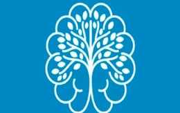 Quiz: Bạn sở hữu tư duy nhạy bén hay là người sống tình cảm