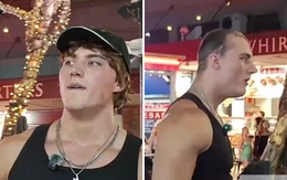 Sao mạng lộ đầu hói khi livestream hút hàng chục triệu lượt xem