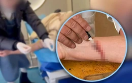 Trung Quốc triệt phá 'ổ nhóm' thầy thuốc dởm dùng liệu pháp chích máu 'giải tà khí'