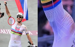 'Cục u' bí ẩn trên tay cua rơ số 1 thế giới Pogacar gây bão mạng