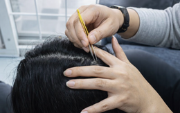 Nhổ tóc bạc cho 'đỡ ngứa mắt', coi chừng tóc không mọc lại