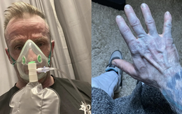 Hoảng hốt nhập viện vì da chuyển... xanh, tìm ra 'thủ phạm' là thứ không ai ngờ