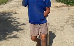 Cụ ông cụt hai tay kẹp con rắn hổ mang về nhà sau khi bị cắn