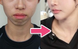 Ảnh quá khứ khó tin của 'nữ thần điền kinh Hàn Quốc'