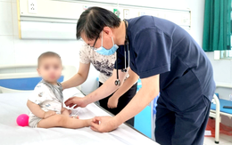 3 tháng gần 25.000 ca mắc tay chân miệng, 4 ca tử vong: Bộ Y tế chỉ đạo khẩn