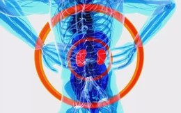 Sống chung với bệnh thận mạn: Điều trị đúng để kéo dài chất lượng sống