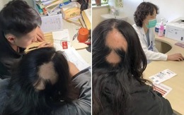 Mẹ hói cả đầu khi dạy con học