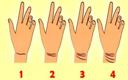 Quiz: Đường kẻ trên cổ tay tiết lộ bạn điềm báo gì?