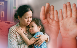 Ba bệnh rình rập trẻ nhỏ mùa nắng