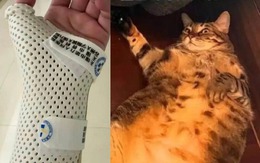 Cô gái gãy tay khi bị chú mèo cưng 7,5kg đè suốt đêm