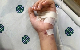 TP.HCM: Bé 11 tuổi tử vong do viêm màng não mô cầu thể tối cấp, diễn tiến rất nhanh