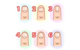 Quiz: Bạn cầu tiến hay là người đầy tham vọng?