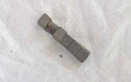 Cấp cứu bé trai nuốt phải nhiều viên nam châm