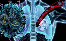 Liệu pháp hạt nano điều trị ung thư phổi và chứng teo cơ cùng lúc