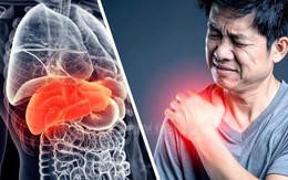 Bỗng dưng bị đau nhức vai bên phải, có khi là tín hiệu cầu cứu từ một cơ quan thiết yếu trong cơ thể