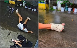 Chàng trai xỏ dép 3 ngón sau cú trượt chân